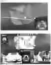 Fig. 04 - DENTAL TREATMENT SYSTEM AND METHOD USING AI TECHNOLOGY