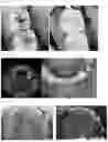Fig. 07 - DENTAL TREATMENT SYSTEM AND METHOD USING AI TECHNOLOGY