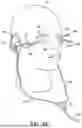 Fig. 15 - SYSTEMS FOR EYE TREATMENT