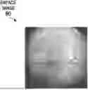 Fig. 01 - GENERATING AND EVALUATING TWO- AND THREE-DIMENSIONAL IMAGES OF THE INTERIOR OF AN EYE