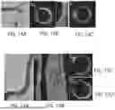 Fig. 15 - SYSTEMS AND METHODS FOR OCT-GUIDED TREATMENT OF A PATIENT
