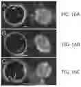 Fig. 16 - SYSTEMS AND METHODS FOR OCT-GUIDED TREATMENT OF A PATIENT