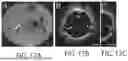 Fig. 17 - SYSTEMS AND METHODS FOR OCT-GUIDED TREATMENT OF A PATIENT