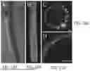 Fig. 22 - SYSTEMS AND METHODS FOR OCT-GUIDED TREATMENT OF A PATIENT