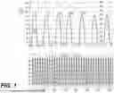 Fig. 02 - NOVEL COMPONENTS FOR A HEMODYNAMIC ANALYSIS TOOL