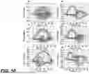 Fig. 11 - NOVEL COMPONENTS FOR A HEMODYNAMIC ANALYSIS TOOL