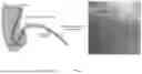 Fig. 24 - NOVEL COMPONENTS FOR A HEMODYNAMIC ANALYSIS TOOL