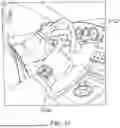 Fig. 32 - OPTICAL SPECTROSCOPY WITH CONTROLLED PATH LENGTH FOR NON-INVASIVE MEASUREMENT THROUGH SKIN
