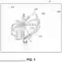 Fig. 04 - METHOD AND SYSTEM FOR ASSISTING A USER IN GUIDING A CATHETER DURING A CARDIAL OPERATION