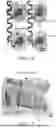Fig. 05 - STRETCHABLE ULTRASONIC TRANSDUCER DEVICES