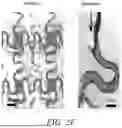Fig. 10 - STRETCHABLE ULTRASONIC TRANSDUCER DEVICES