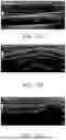 Fig. 100 - STRETCHABLE ULTRASONIC TRANSDUCER DEVICES