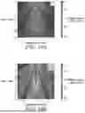 Fig. 101 - STRETCHABLE ULTRASONIC TRANSDUCER DEVICES