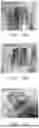 Fig. 105 - STRETCHABLE ULTRASONIC TRANSDUCER DEVICES