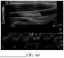 Fig. 111 - STRETCHABLE ULTRASONIC TRANSDUCER DEVICES