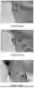 Fig. 114 - STRETCHABLE ULTRASONIC TRANSDUCER DEVICES
