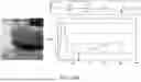 Fig. 118 - STRETCHABLE ULTRASONIC TRANSDUCER DEVICES