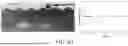 Fig. 21 - STRETCHABLE ULTRASONIC TRANSDUCER DEVICES