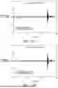 Fig. 61 - STRETCHABLE ULTRASONIC TRANSDUCER DEVICES