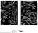 Fig. 70 - STRETCHABLE ULTRASONIC TRANSDUCER DEVICES