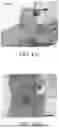 Fig. 75 - STRETCHABLE ULTRASONIC TRANSDUCER DEVICES