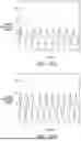 Fig. 76 - STRETCHABLE ULTRASONIC TRANSDUCER DEVICES