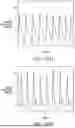 Fig. 77 - STRETCHABLE ULTRASONIC TRANSDUCER DEVICES