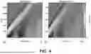 Fig. 04 - ESTIMATION OF VISCOELASTICITY OF ARTERIAL OR VENOUS WALL