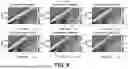 Fig. 09 - ESTIMATION OF VISCOELASTICITY OF ARTERIAL OR VENOUS WALL