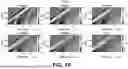 Fig. 10 - ESTIMATION OF VISCOELASTICITY OF ARTERIAL OR VENOUS WALL