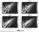 Fig. 11 - ESTIMATION OF VISCOELASTICITY OF ARTERIAL OR VENOUS WALL