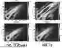 Fig. 12 - ESTIMATION OF VISCOELASTICITY OF ARTERIAL OR VENOUS WALL