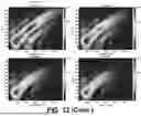 Fig. 13 - ESTIMATION OF VISCOELASTICITY OF ARTERIAL OR VENOUS WALL