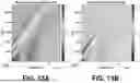 Fig. 14 - ESTIMATION OF VISCOELASTICITY OF ARTERIAL OR VENOUS WALL