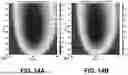 Fig. 15 - ESTIMATION OF VISCOELASTICITY OF ARTERIAL OR VENOUS WALL