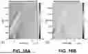 Fig. 17 - ESTIMATION OF VISCOELASTICITY OF ARTERIAL OR VENOUS WALL