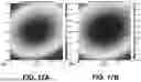 Fig. 18 - ESTIMATION OF VISCOELASTICITY OF ARTERIAL OR VENOUS WALL