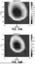 Fig. 20 - ESTIMATION OF VISCOELASTICITY OF ARTERIAL OR VENOUS WALL
