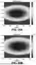 Fig. 21 - ESTIMATION OF VISCOELASTICITY OF ARTERIAL OR VENOUS WALL