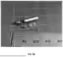 Fig. 07 - SYSTEMS AND METHODS FOR ROBOTIC ENDOLUMINAL SUTURING INSTRUMENT