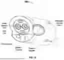 Fig. 17 - SYSTEMS AND METHODS FOR ROBOTIC ENDOLUMINAL SUTURING INSTRUMENT