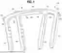 Fig. 02 - SURGICAL STAPLE