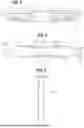 Fig. 04 - SURGICAL STAPLE