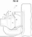 Fig. 15 - SURGICAL STAPLE