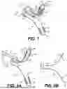 Fig. 02 - SYSTEMS, DEVICES, AND RELATED METHODS FOR FASTENING TISSUE