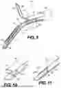 Fig. 05 - SYSTEMS, DEVICES, AND RELATED METHODS FOR FASTENING TISSUE