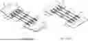 Fig. 17 - Closure Apparatuses and Methods for Ulcers and Irregular Skin Defects