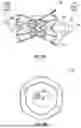 Fig. 07 - INTERATRIAL SHUNT HAVING PHYSIOLOGIC SENSOR