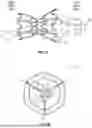 Fig. 09 - INTERATRIAL SHUNT HAVING PHYSIOLOGIC SENSOR