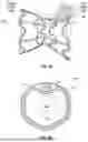 Fig. 11 - INTERATRIAL SHUNT HAVING PHYSIOLOGIC SENSOR